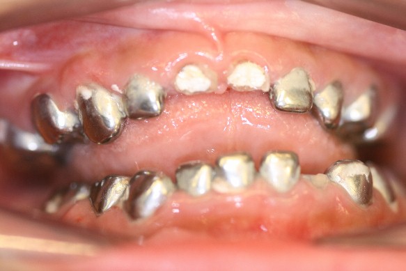 Tooth2.jpg